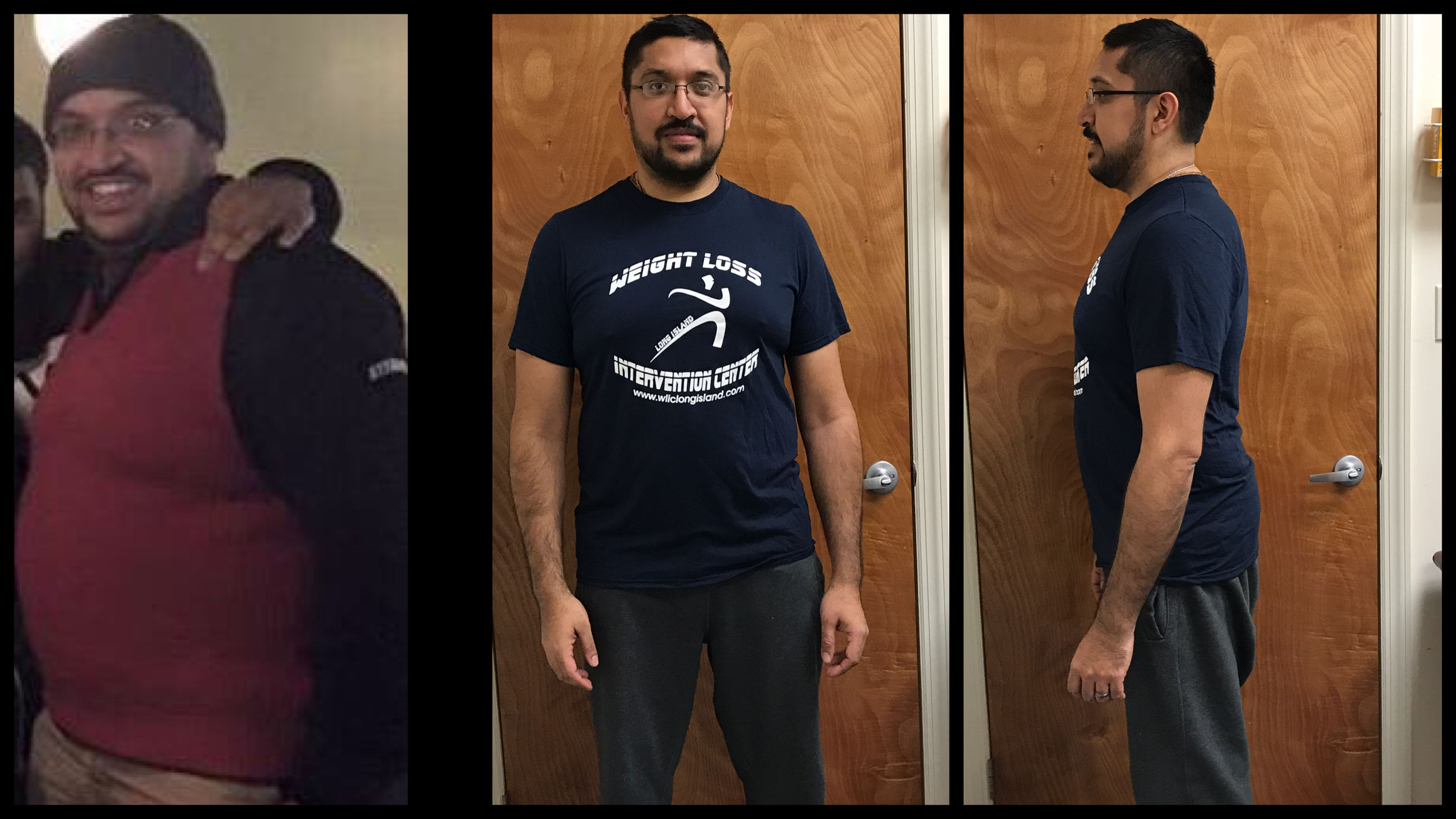 Weight Loss Intervention of Long Island Results